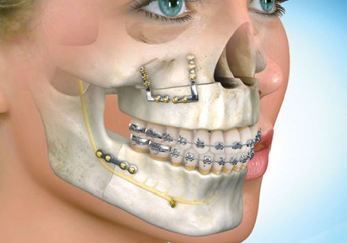 Tratamento orto-cirúrgico